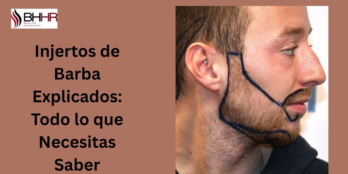 Injertos de Barba Explicados: Todo lo que Necesitas Saber