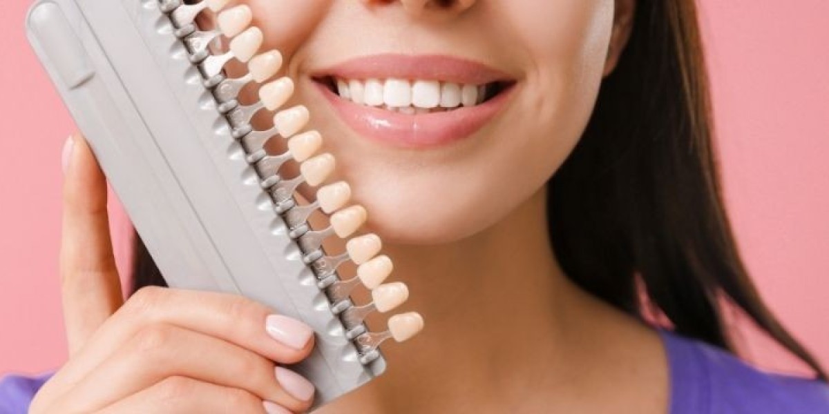 Perfect Smile: Dental Veneers Cost and Aesthetic Benefits