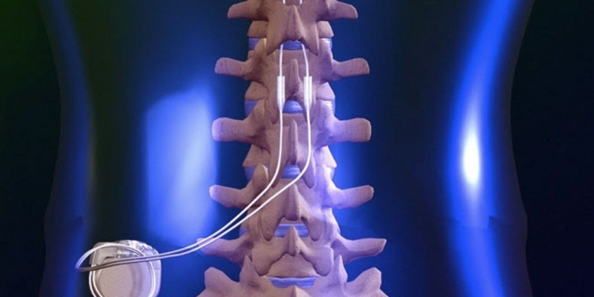 Spinal Cord Stimulation in Dallas TX for Chronic Pain Relief