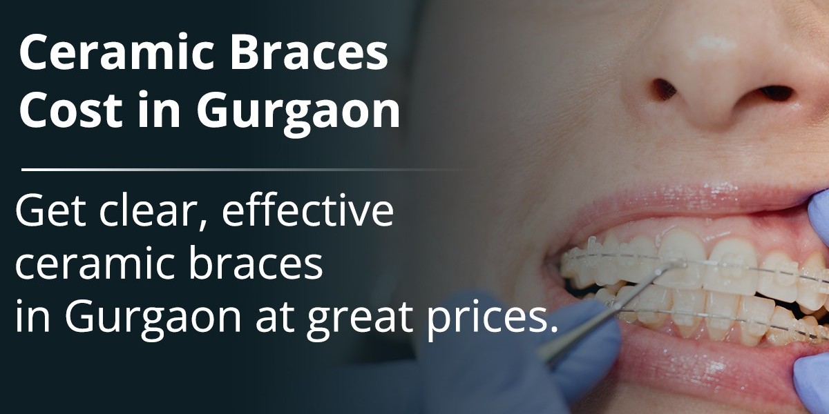 Are Ceramic Braces for You? A Guide for Adults and Professionals
