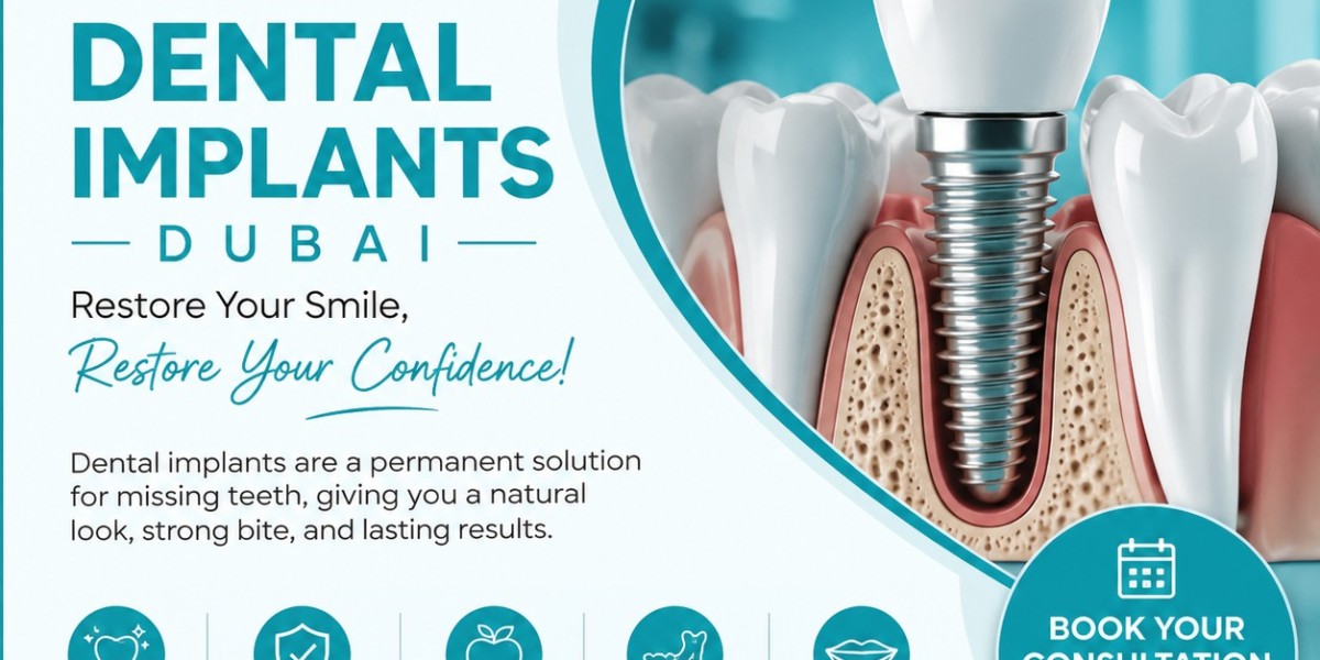 Best Dental Implants Dubai | Restore Your Smile at Top Smile Dental Clinic