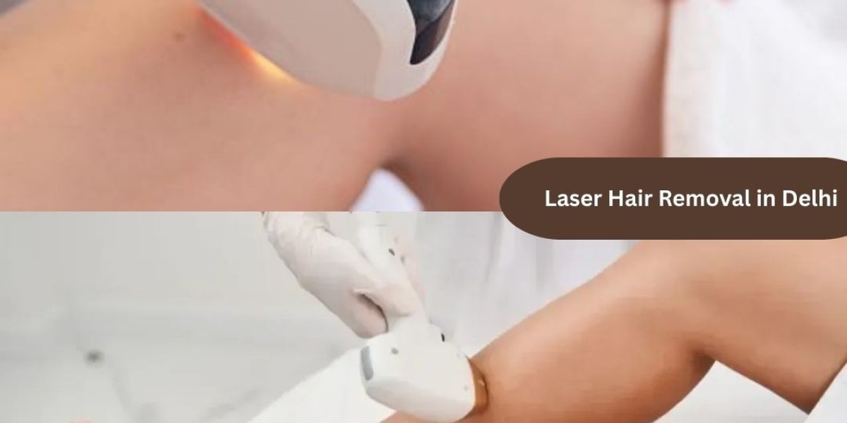 Is Laser Hair Removal Worth It? A Practical Guide for Anyone Considering It in Delhi
