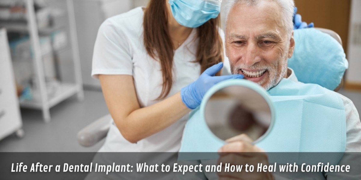Life After a Dental Implant: What to Expect and How to Heal with Confidence