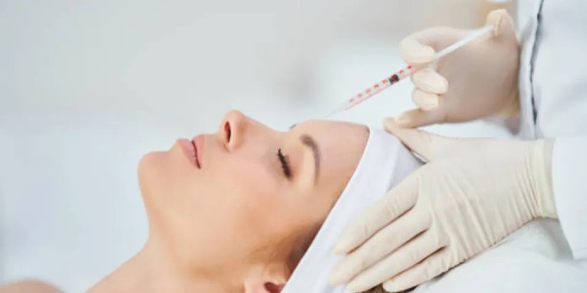 Juvederm Filler for Smile Line Correction