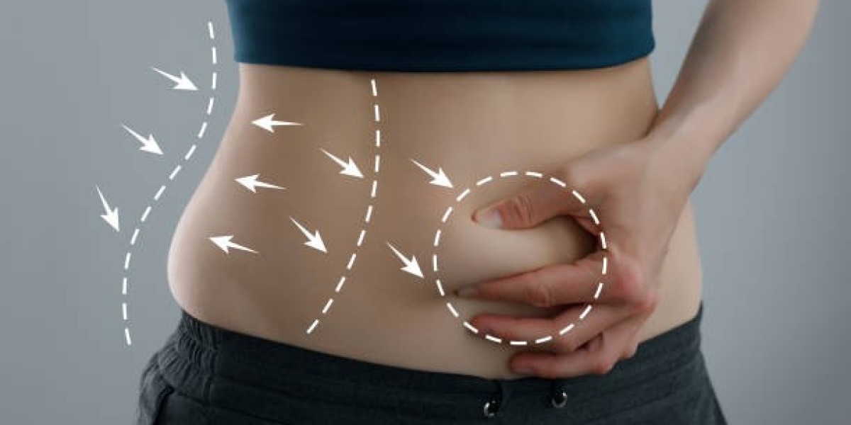 Non Invasive Fat Removal and the Future of Body Sculpting