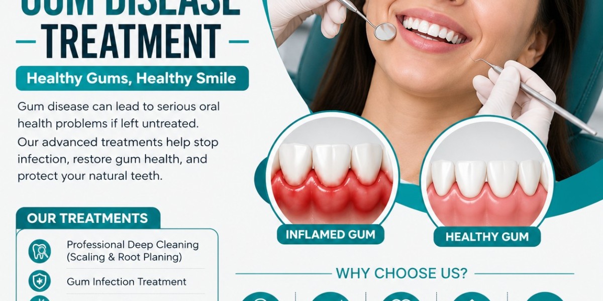 Gum Disease Treatment in Dubai: Protect Your Smile Before It's Too Late
