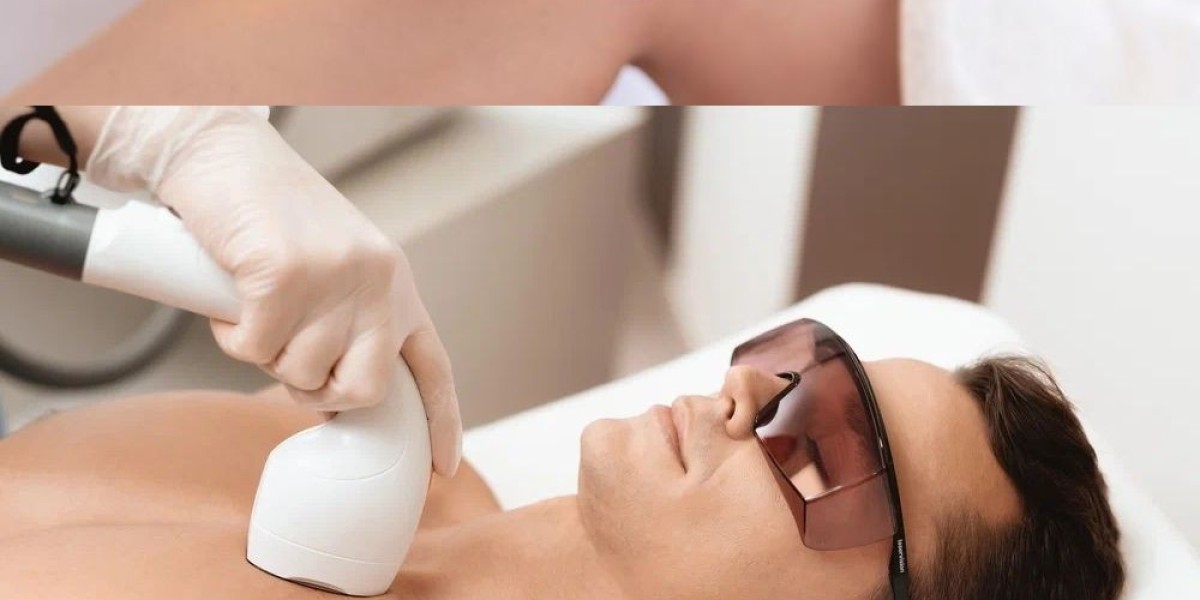 Tired of Waxing Every Few Weeks? Here Is What Laser Hair Removal Actually Does