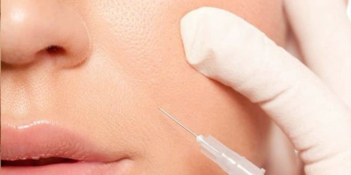 Belotero Fillers in Dubai: Advanced Facial Softening
