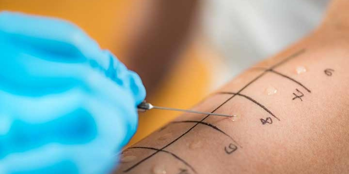 Why Choosing a Skilled Allergist Irvine Matters for Your Health