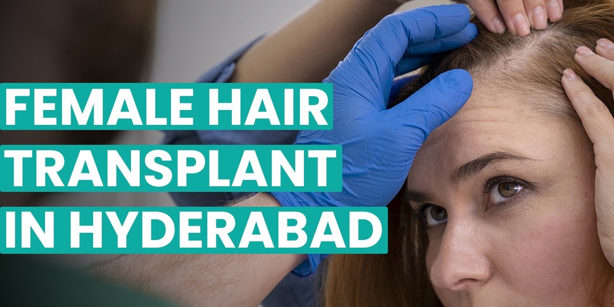 Hair Loss in Women: Understanding Treatment Options in Hyderabad