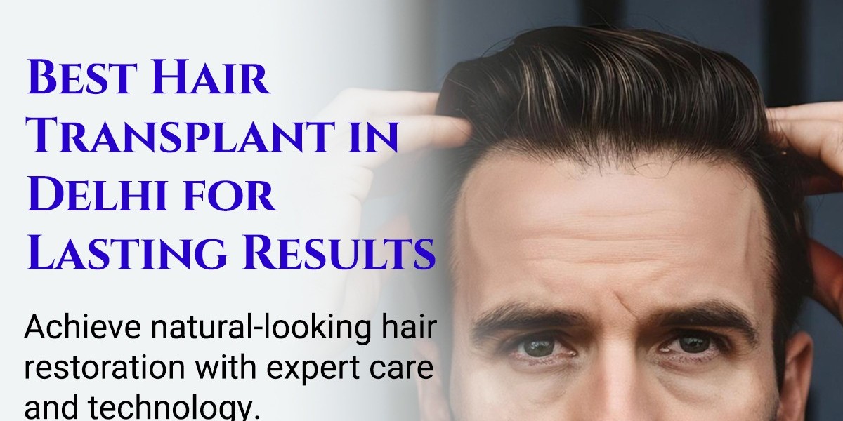 Choosing the Right Path for Hair Transplant Surgery in Delhi