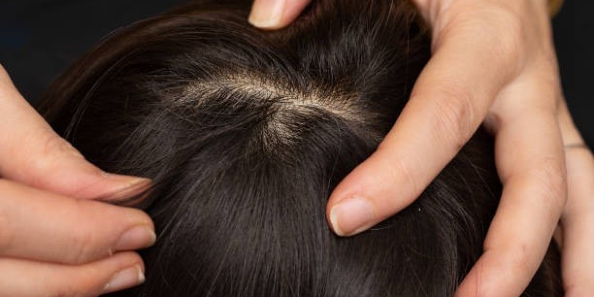 How Fast Does Exosomes Therapy Show Results for Hair Growth?