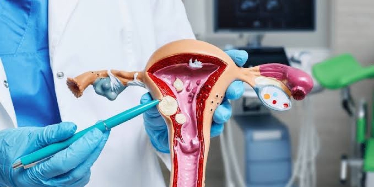 Understanding PCOS, Period Problems, and When to See a Gynecologist