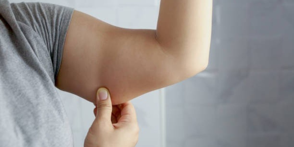 Scarring After Arm Lift Surgery: What You Should Know