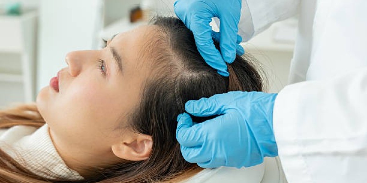 Exosome Hair in Dubai: Boosting Hair Transplant Results