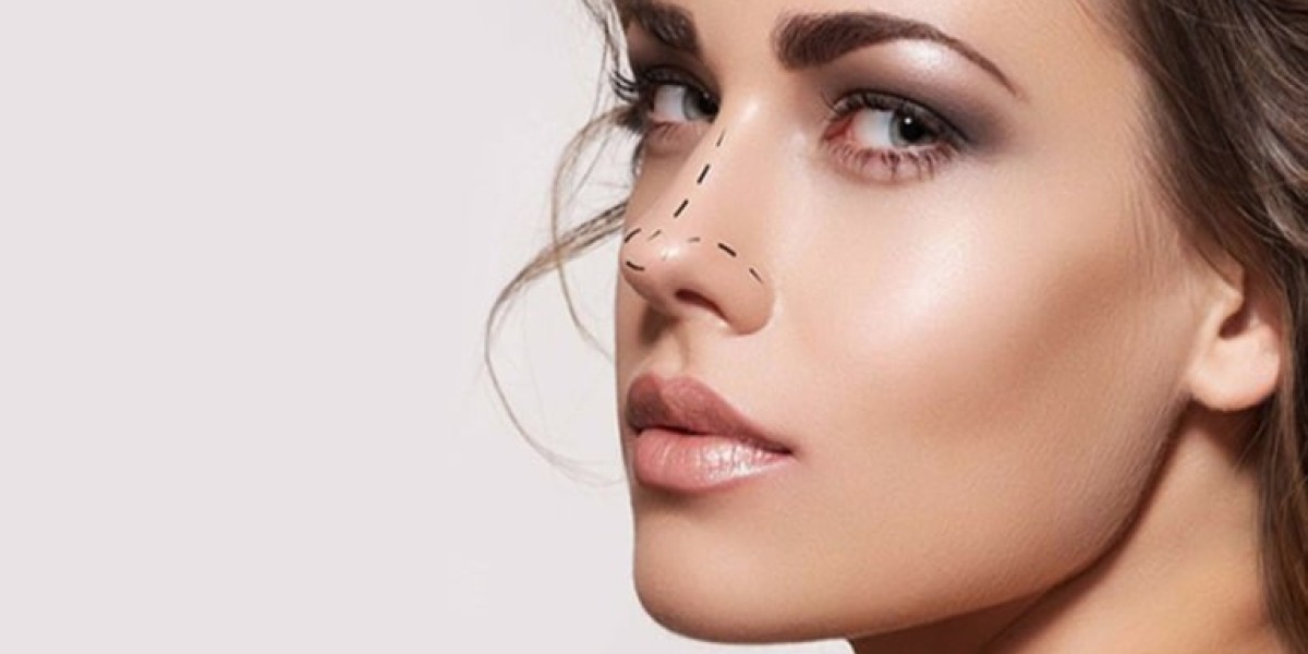 How to Choose the Right Rhinoplasty in Dubai Provider