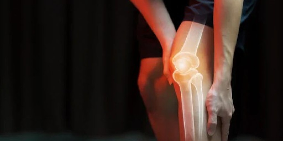Top Knee Pain Relief Device for Everyday Comfort and Support