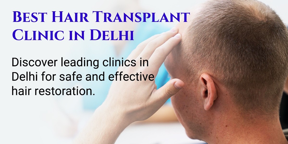 Is FUE Hair Transplant the Right Choice for You? Here's What You Should Know Before Deciding