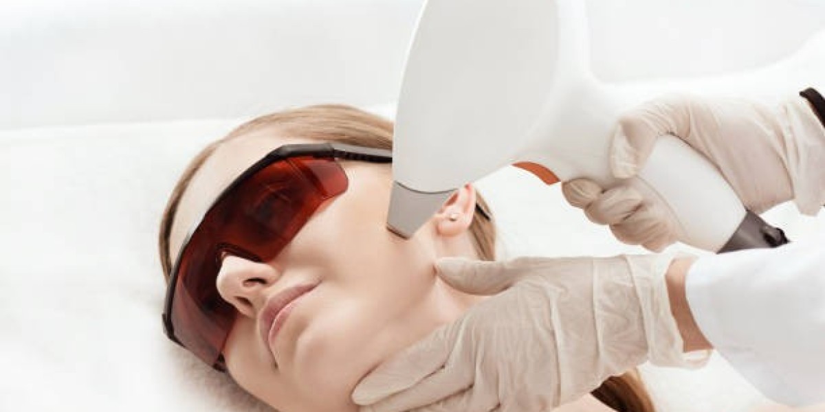 Q-switch Laser Benefits for Stubborn Pigmentation Issues