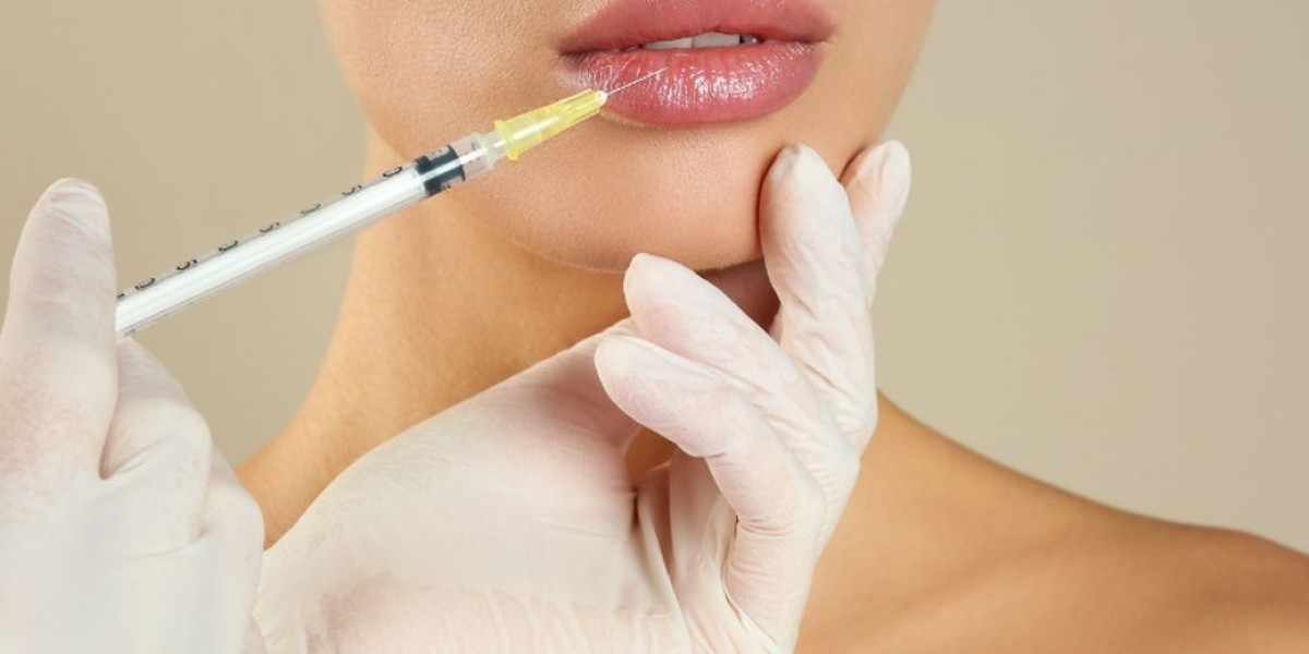 Can Russian Lip Fillers Add Height Without Extra Volume?