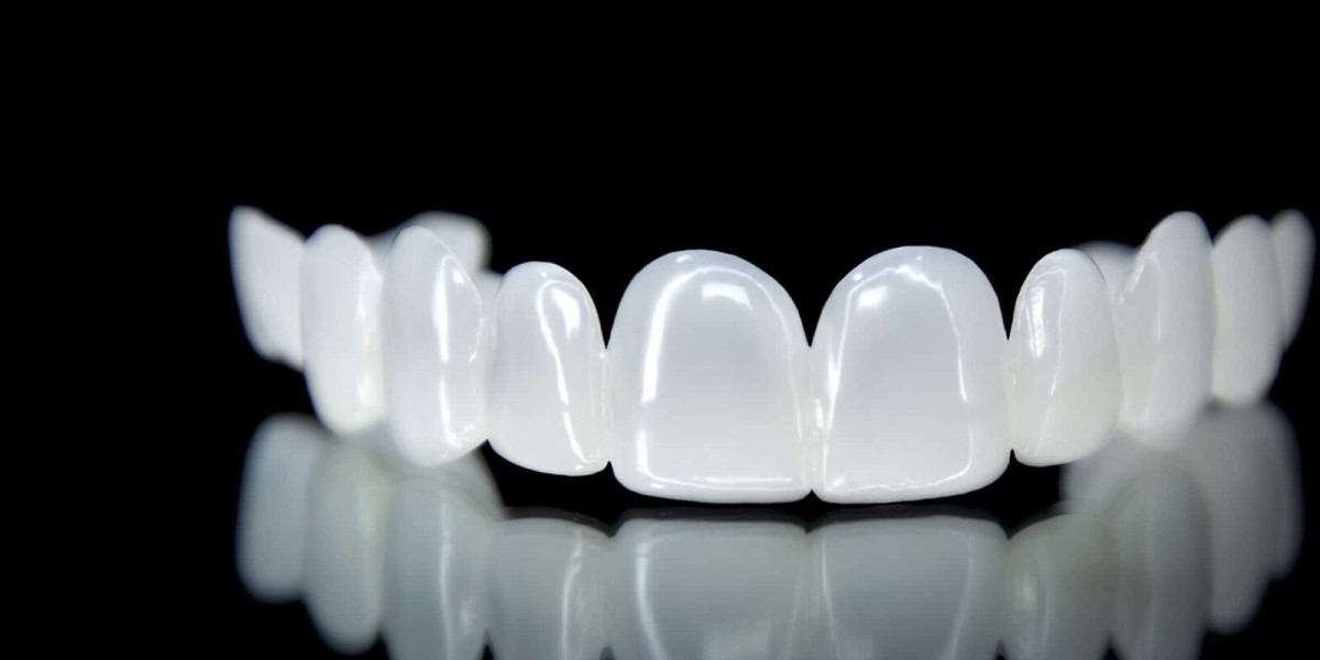 Are the Best Dental Veneers in Dubai Worth It?