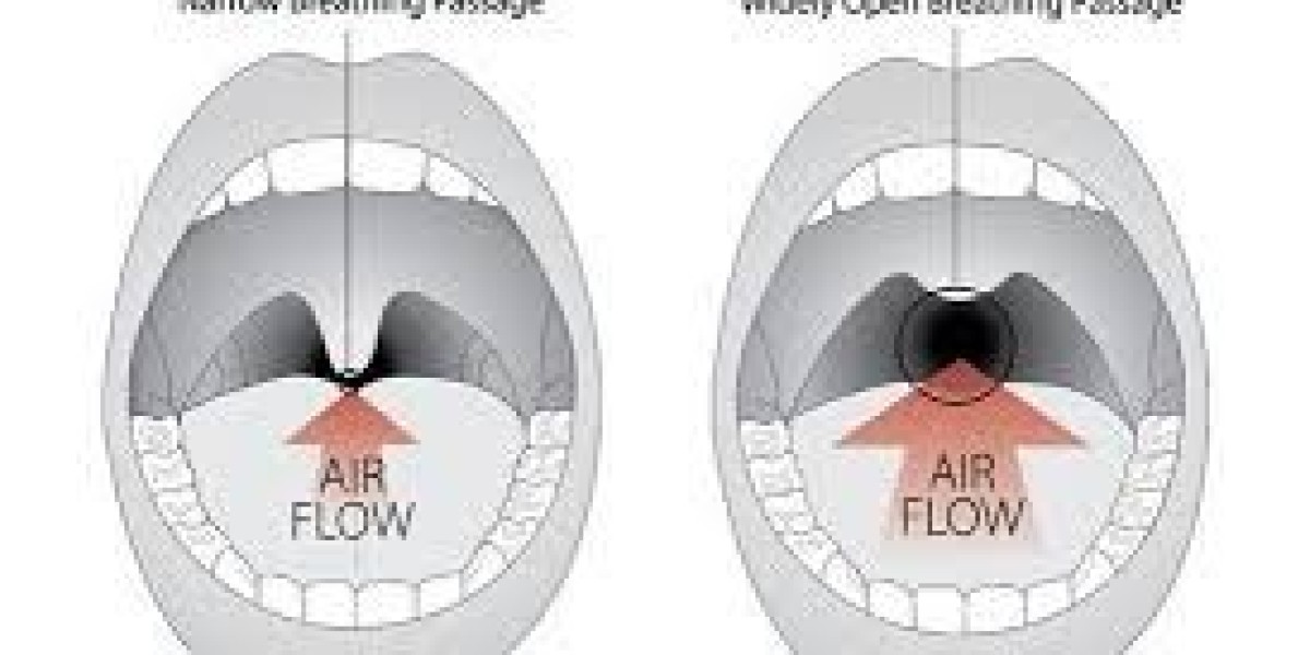 Snoring Treatment in Dubai | Effective Solutions for Peaceful Sleep