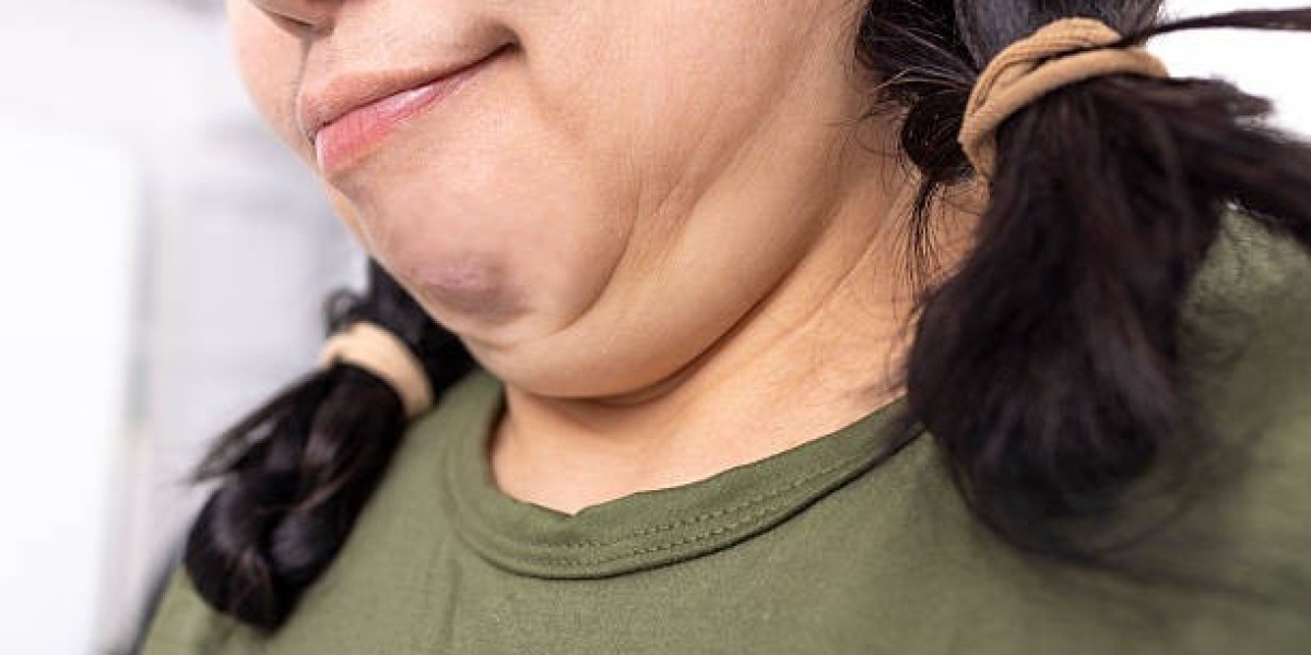 Chin Reduction in Dubai to Achieve a Youthful Profile