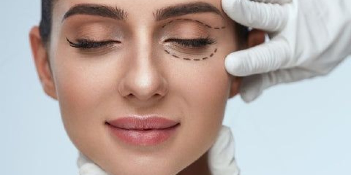 Achieve Naturally Refreshed Eyes with Cosmetic Eyelid Surgery in Islamabad