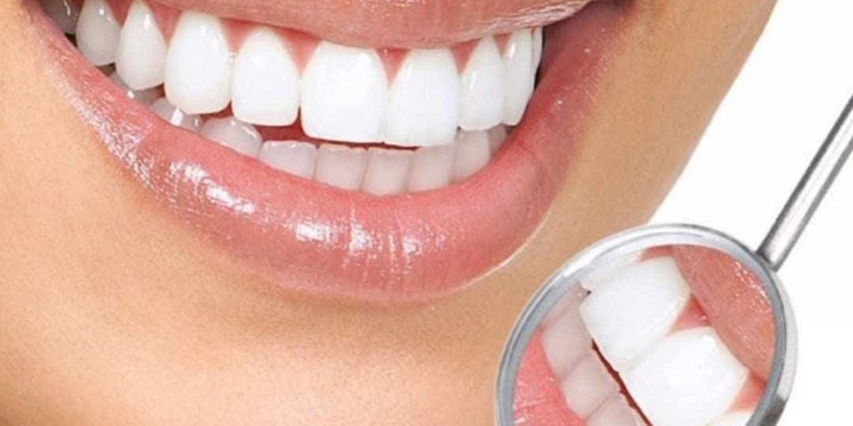 Teeth Cleaning in Dubai: What to Expect