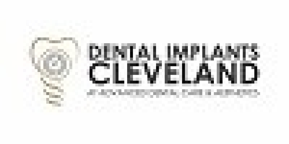 Restore Your Smile with Full Arch Dental Implants in Cleveland, OH