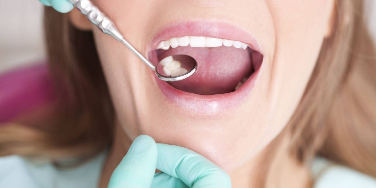 Dental Clinic in Dubai for Dental Implants