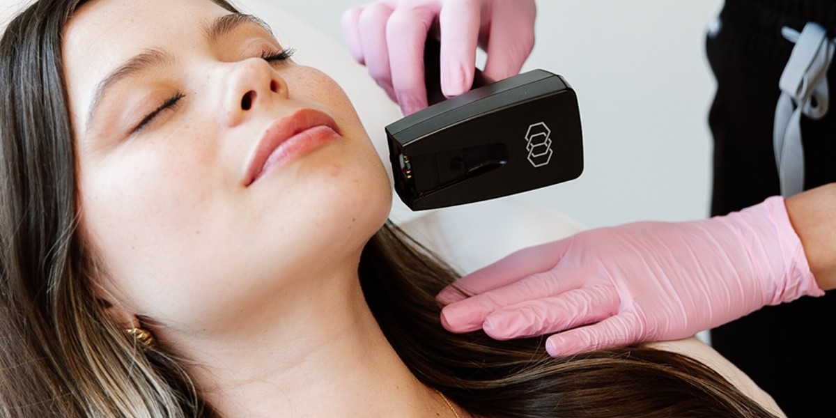 Why Do Experts Recommend Morpheus8 for Skin Tightening?