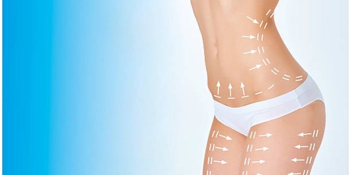 Liposuction to Reshape Your Body with Confidence