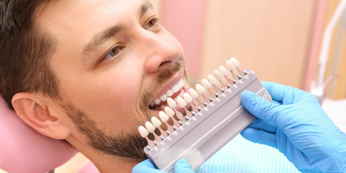 Veneers Dubai for Chipped and Broken Teeth