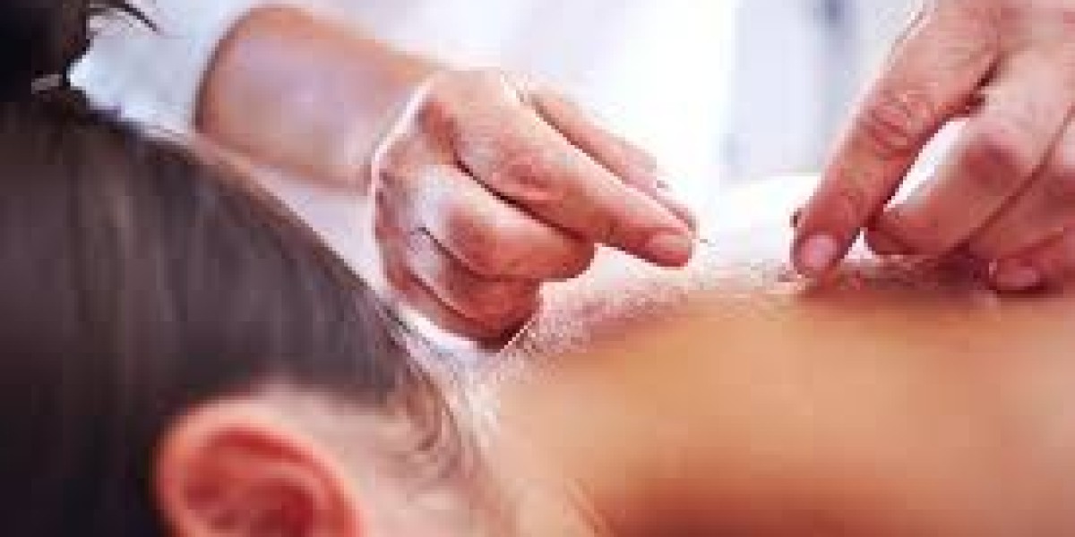 Acupuncture Treatment in Dubai | Natural Healing & Wellness Guide