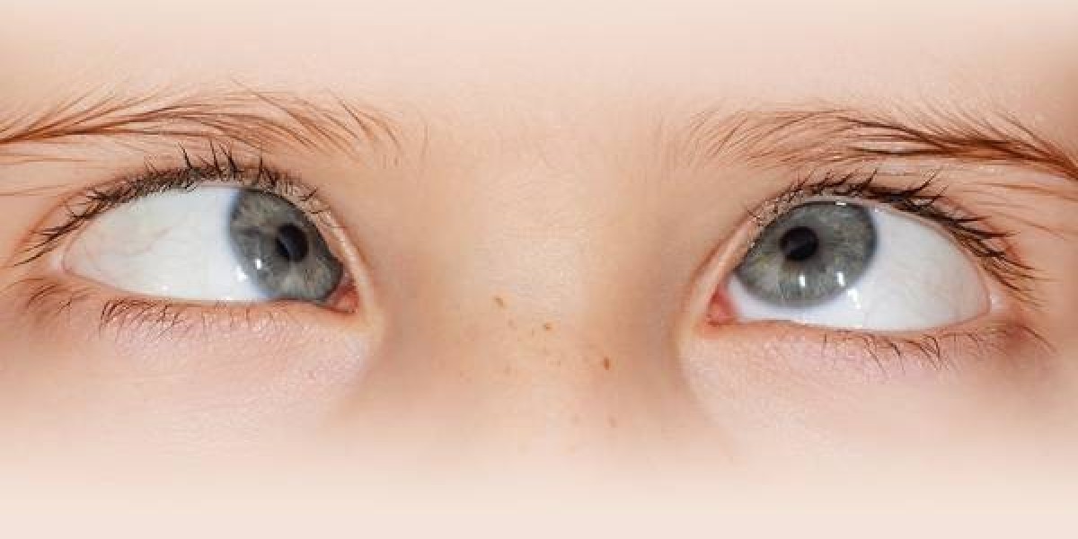 Squint Eye Specialist in Pune: Expert Diagnosis and Treatment for Better Eye Alignment