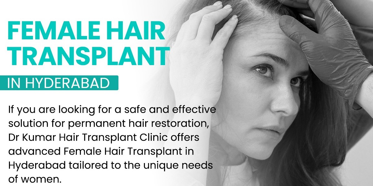 Hair Transplant Guide for Patients in Hyderabad