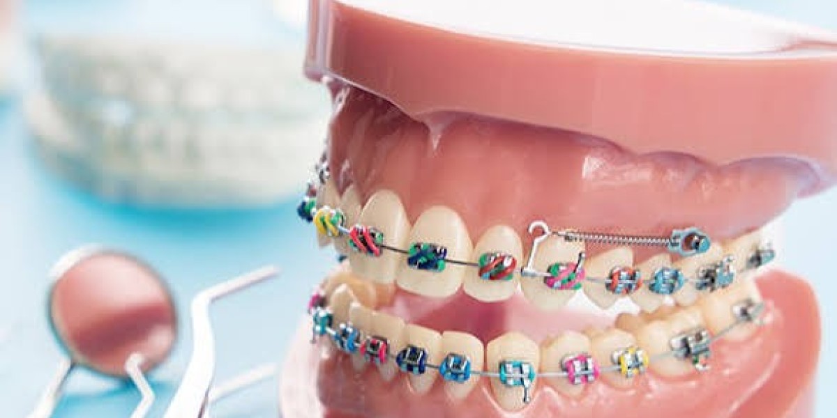 Orthodontics Market Intelligence Report: Key Growth Drivers, Regional Trends & Future Opportunities