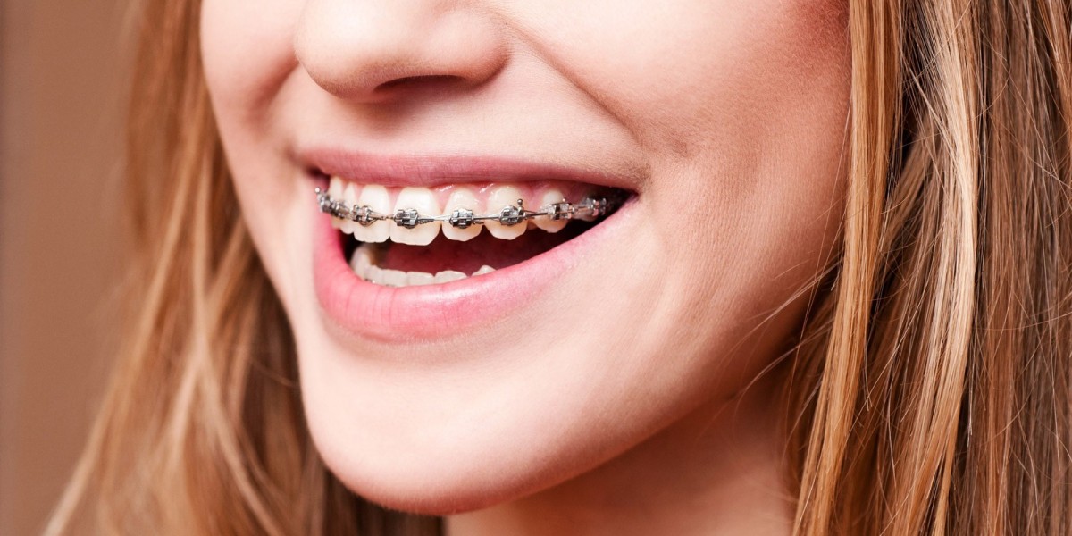 Benefits of Choosing a Dental Clinic Dubai